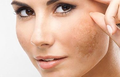 Vì sao xài retinol bị xạm da và cách khắc phục