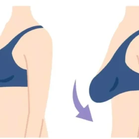 ngực xệ nên mặc áo ngực như thế nào